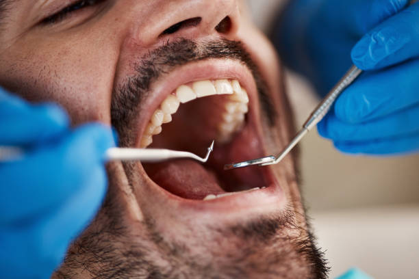 Best Emergency Dental Care for Broken or Chipped Teeth in Harmony Grove, CA