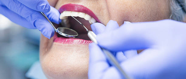 Best Emergency Dental Care for Broken or Chipped Teeth in Harmony Grove, CA